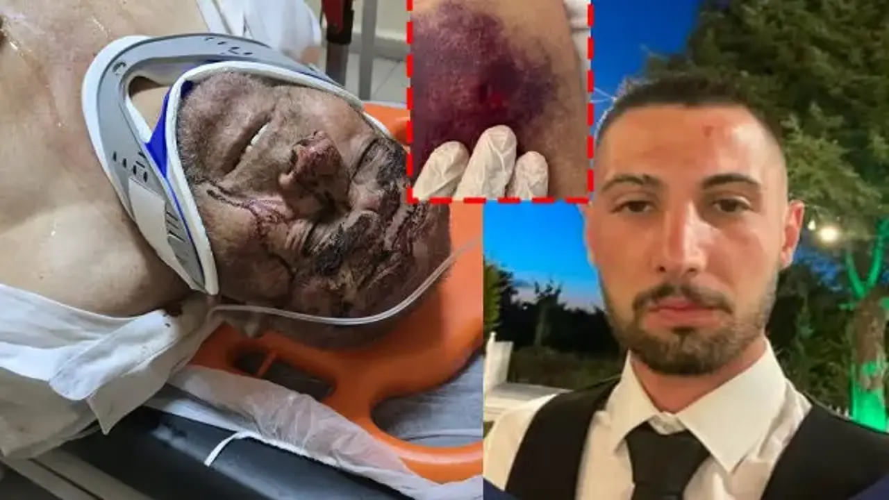 Çanakkale’de akılalmaz olay! 150 bardak çay için öldüresiye dövüldü