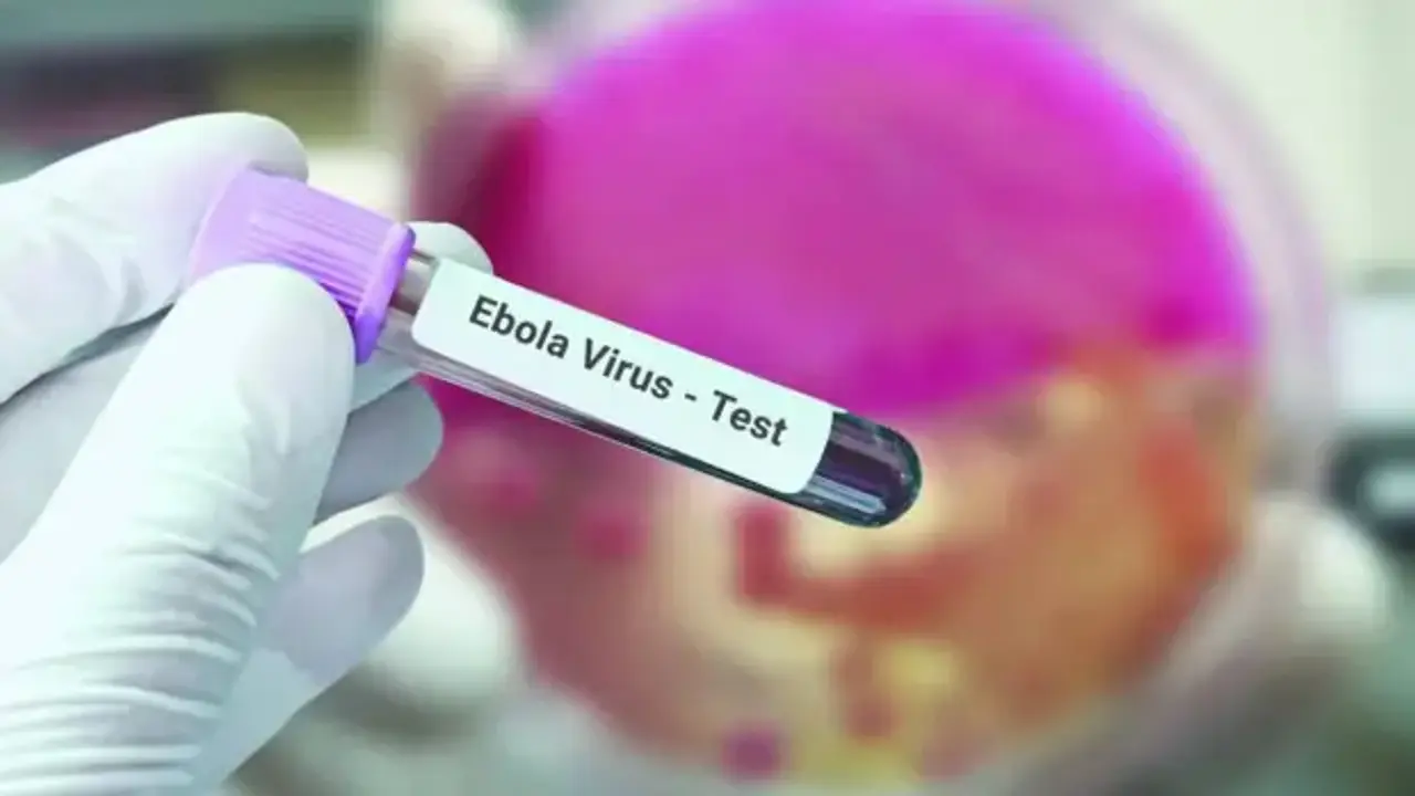 Fransa'da ebola vakası görüldü