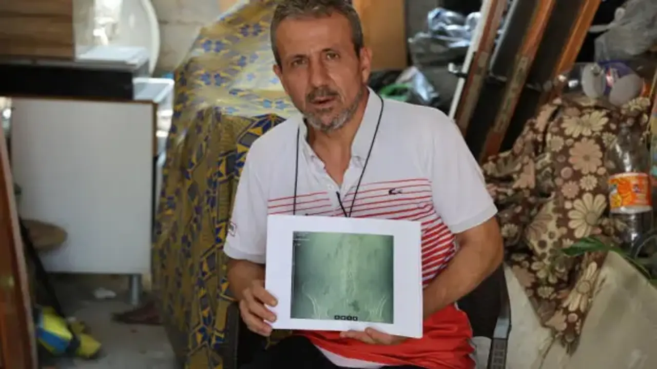 İş kazası geçirdi, ameliyat oldu, belinde panç unutuldu