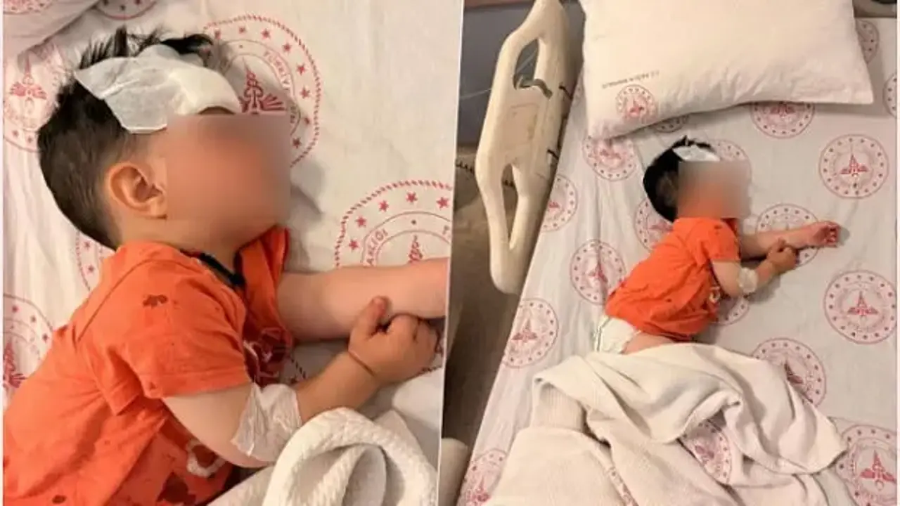 Şanlıurfa'da küçük çocuğu yaralayan köpek saldırısına idari soruşturma