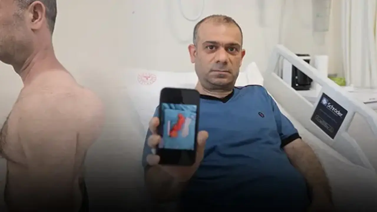 Sırtındaki şişliği önemsemedi! Yıllar içinde büyüdü! Doktorları şoke eden vaka