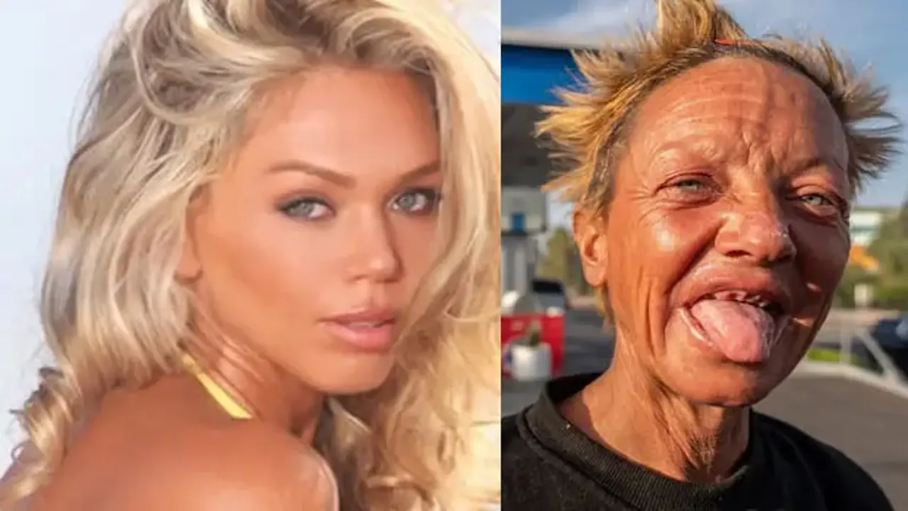 Ünlü model tanınmaz halde! Servetini kaybetti, sokaklara düştü