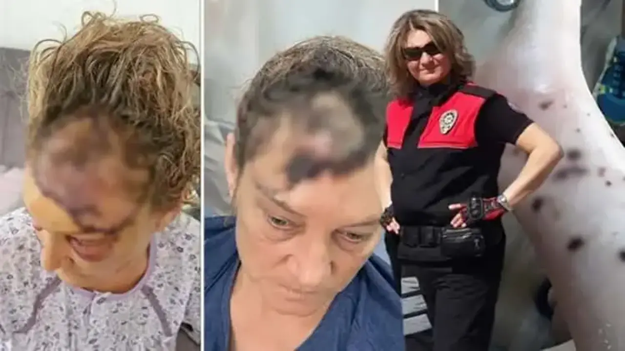 Vücuduna 80 dikiş atıldı: Patronunun köpeği tarafından parçalanan koruma isyan etti