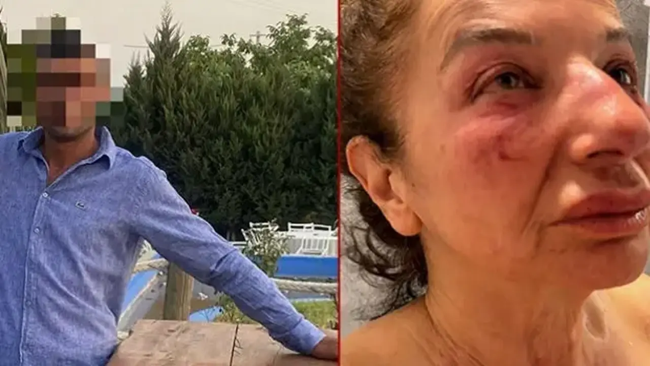 Yalanla ayağına çağırdı öldüresiye dövdü! Saldırgan belediye çalışanı çıktı