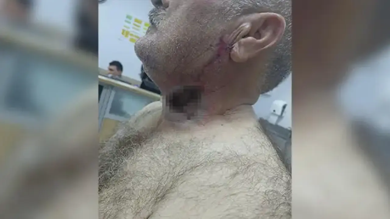 Yere düşürdü, üstünde tepindi: At, sahibini boğazından ısırdı!