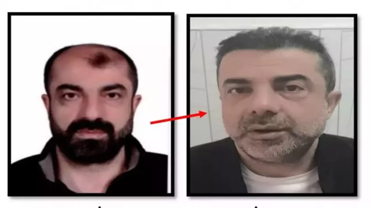 Yüzünü değiştiren firari zanlı 7 yıl sonra yakalandı